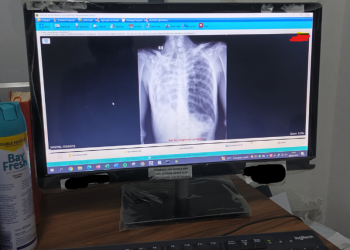 Wujudkan Digitalisasi Layanan RS PKU Demak Kembangkan Picture Archiving Communication System (PACS)