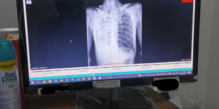 Wujudkan Digitalisasi Layanan RS PKU Demak Kembangkan Picture Archiving Communication System (PACS)